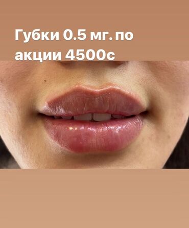 увеличение груд: Увеличение губ с использованием 0,5 мг препарата. Процедура по акции