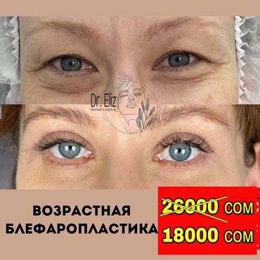 электро эпиляция: Клиника | Хирург | Башка медициналык кызматтар