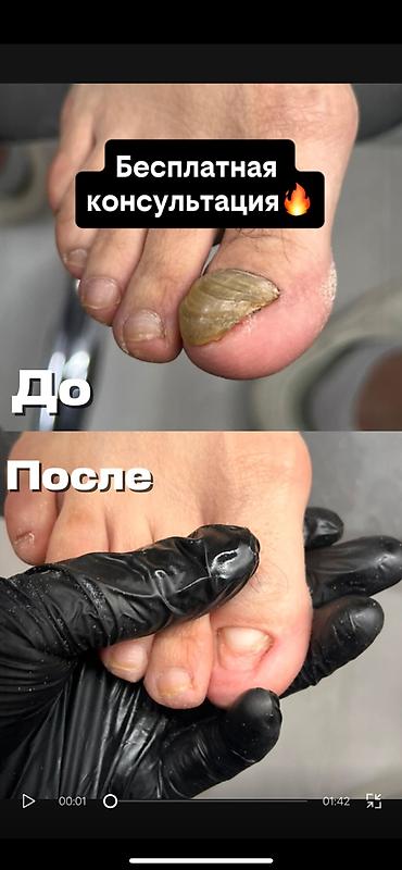 травмаь: Подолог Бишкек Подолог Бишкек Подолог Бишкек Подолог Бишкек Подолог — 1