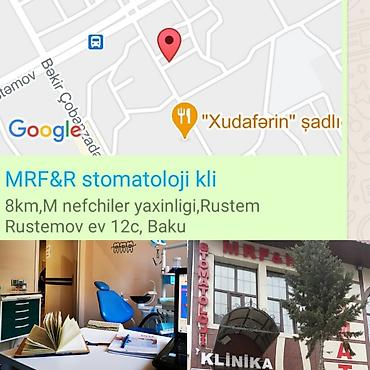 сколько стоят брекеты в баку: İnstaqram dr.zerif). Seçilən pasientlerə sonda kappa hədiyyə — 8
