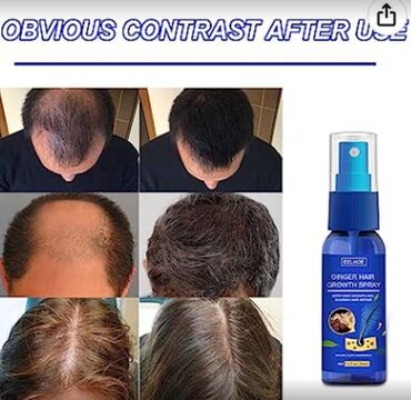 США спрей для роста волос от облысения - смотрим фото читаем ЦЕНА-