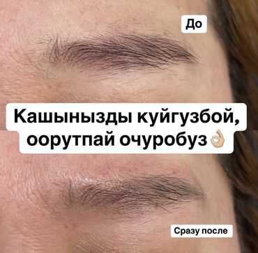 Перманентный макияж: АКЦИЯ !АКЦИЯ! Новый метод удаления Сейчас по акции Лазерное удаление — 15