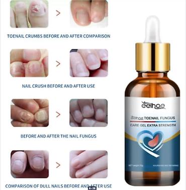 foot patch: Средства от грибка ногтей 18 видов США - все в теме - оптом и в — 6