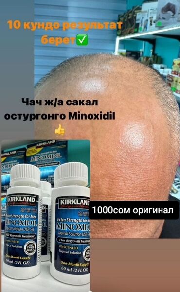 чач үтүк: Minaksidil. Чач Жана Сакалга ото ефективду продукта кайрылыныздар!!