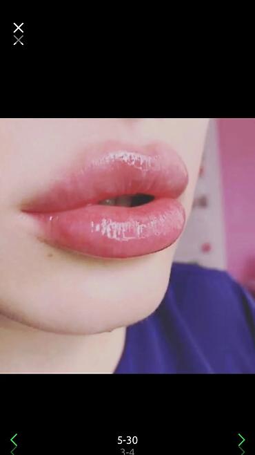 Косметология: Косметология, Ботокс, Биоревитализация, Ботулинотерапия, Консультация, Гипоаллергенные материалы, Сертифицированный косметолог at lalafo.kg — 8 Косметология: Косметология, Ботокс, Биоревитализация, Ботулинотерапия, Консультация, Гипоаллергенные материалы, Сертифицированный косметолог — 8