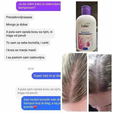 Nega kose: 🌸 Recite ZBOGOM peruti! 🌸 Isprobali ste sve, ali perut i dalje tu? 😕 — 3