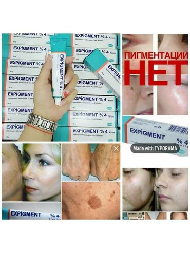 expigment купить в аптеке: Пигментация на разных участках кожи, особенно на лице влияют на