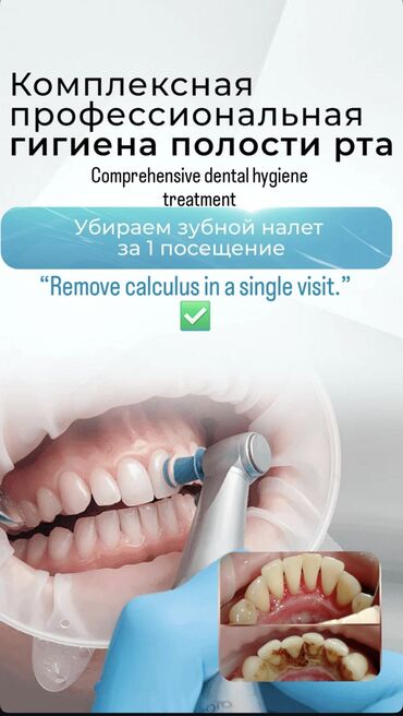 удаление татуажа лазером цена: Акция! 4 х этапное чистка Зубов 1500с (вместо 3500) .( адрес 7мкр) По