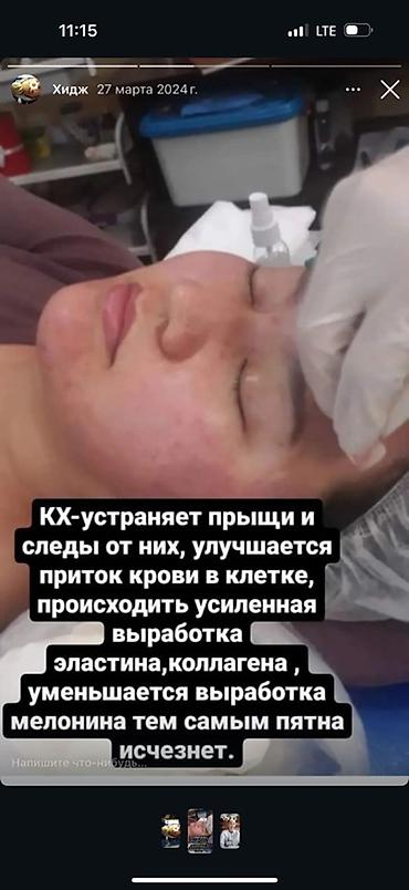 Медицинские услуги: Массаж БЭМ ( биоэнергомассаж) -глубокое стимулирование мышцснимает — 8