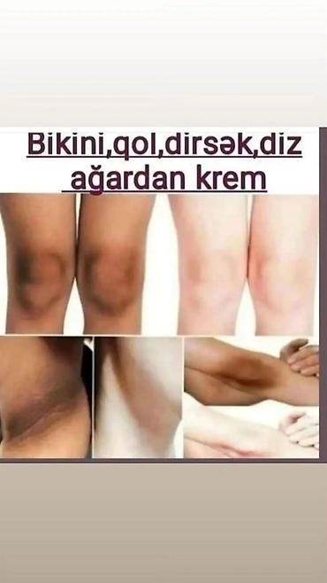 Gözəllik və sağlamlıq: Ətraflı yan şəkillərdə metrolara çatdırılma var rayona poçtla — 4