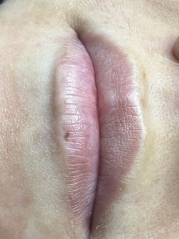 Косметология: Косметология, Маски, Мезотерапия, Удаление носогубных складок, Гипоаллергенные материалы, Консультация, Сертифицированный косметолог — 81