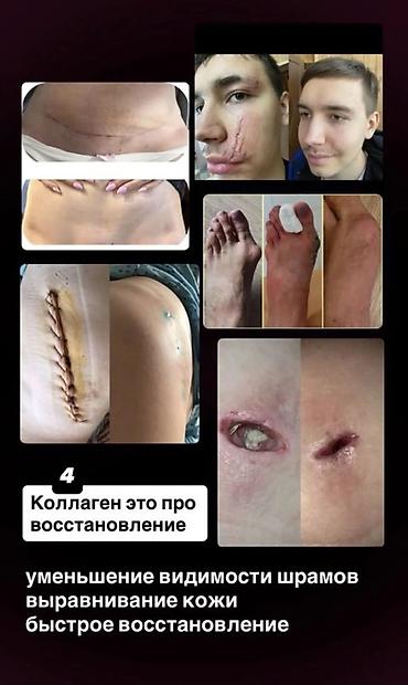 Мед. товарлар: Коллаген, Чачтын өсүшү үчүн, Универсалдуу, Желе, Жаңы — 4