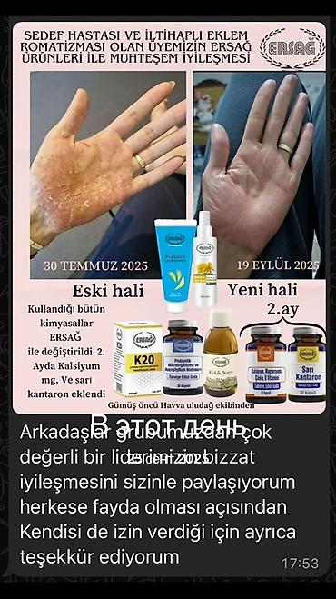 ERSAĞ dəri və oynaq rahatlığı üçün dəst Məhsullar: - ERSAĞ Vücut
