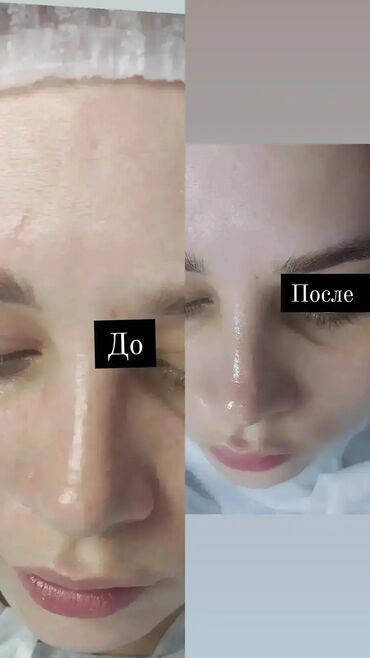 Косметология: Косметолог с медицинским образованием чистка лица пилинг осветление — 2