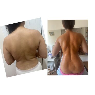 permanent qaş qiymeti: Вакуумный массаж, Для женщин