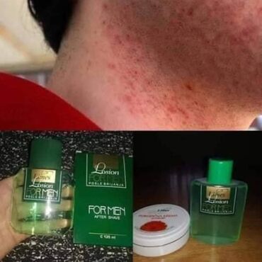 la prairie krema za lice cena: 🌿 losion posle brijanja 🌿 iritacija nakon brijanja - više nikad!