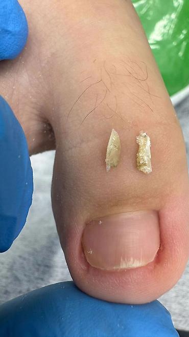 Маникюр: Коррекция вросших ногтей, Маникюр, Педикюр, Услуги подолога, С выездом на дом, Консультация, Одноразовые расходные материалы — 4