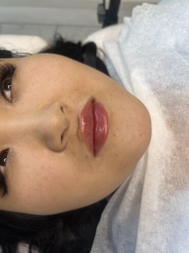 Косметология: Косметология, Биоревитализация, Ботокс, Ботулинотерапия, Требуются модели, Гипоаллергенные материалы, Консультация — 7