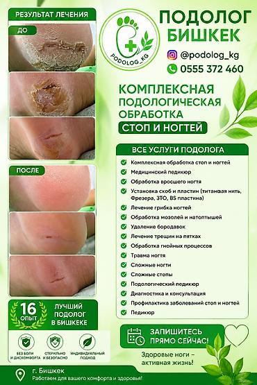 удаление папилломы бишкек: Коррекция вросших ногтей, Услуги подолога, Одноразовые расходные материалы — 3
