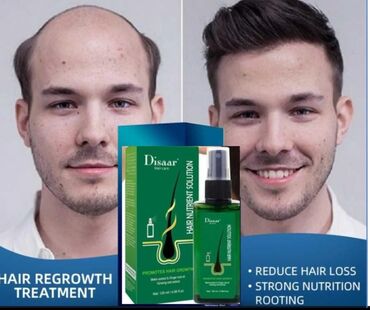 bio extra losyon: Disaar sac cxardan losyon sprey saclara verdiyi effekti ✔Tökülmeni