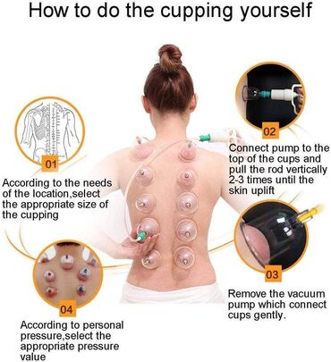 Lepota i zdravlje: Ventuze . CUPPING-fizikalna terapija-akupunktura- čašama Komplet za — 11
