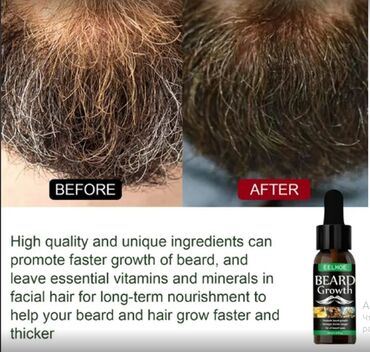 Уход за телом: США для роста волос для роста бороды от облысения от алопеции от — 3