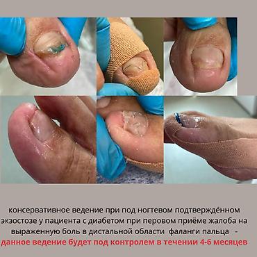 остеохондроз массаж: Врачи | — 1
