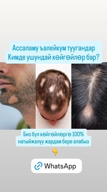 эффективное лечение алкоголизма: Услуга по решению проблем очагового выпадения волос и залысин -