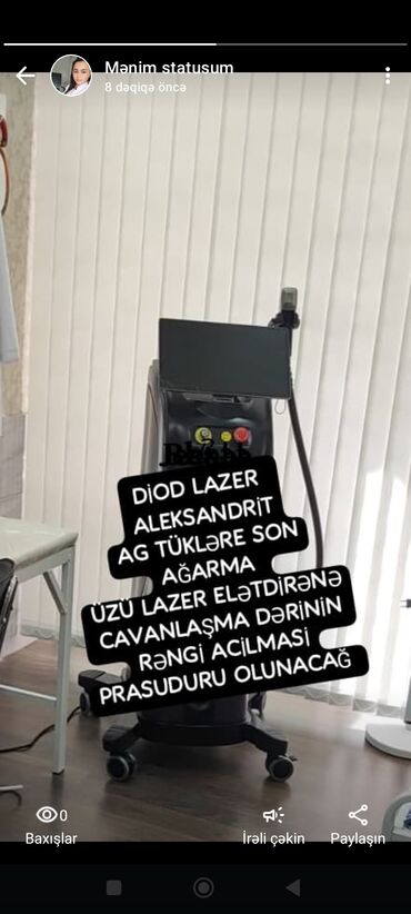 ten effektli qaşlar: DIOD Lazer Aleksandrit Ağ tüklər üçün elektron epilyasiya AGARMA