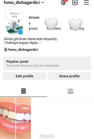 hicab donlar: Dişinizin 1 həftəyə gözlə görünən derecede beyazlamagini