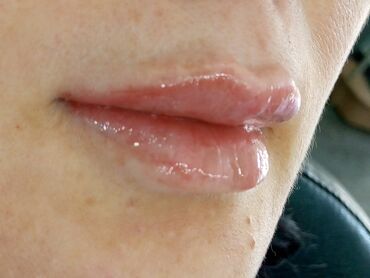 Косметология: Косметология, Биоревитализация, Ботулинотерапия, Контурное моделирование, Гипоаллергенные материалы, Консультация, Сертифицированный косметолог — 13