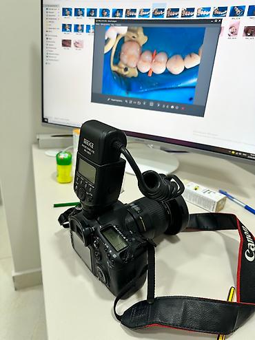 Фотоаппараты: Canon EOS 7D Macro 100 mm Для дентального фото . Комплект : кольцевая — 2