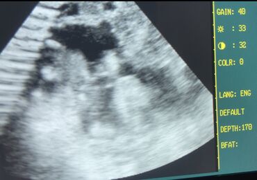 Услуги ветеринара: Ветеринардык врач …! Ветеринарный врач …! Узи🐄🐎🐑🐐🐕🐈 Бодо малга — 3