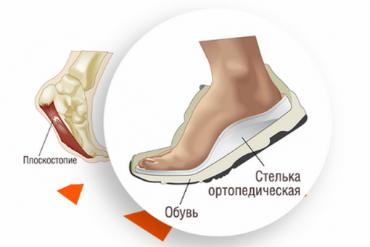 обувь с подогревом: Стельки ортопедические(специализированные) от плоскостопия Для