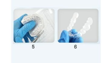 Медицинское оборудование: Пластины для капп разной толщины: 0,8мм, 1мм, 1,5мм, 2,0мм, 2,5мм — 12