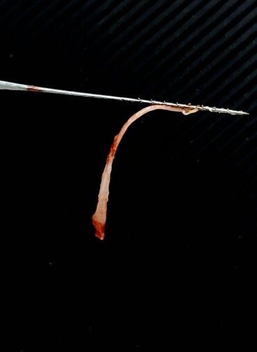 İşıqlandırma: Məhsul: Smartfon üçün diş həkimi çəkiliş seti – LED halqa işıqlı — 10