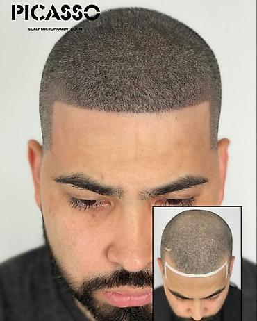 mühafizə xidməti: Tatto nökte atişiylariyla tük effekti yaradib keçelliyi örten — 2