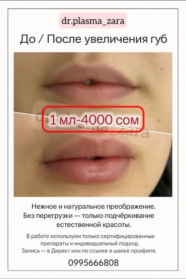 сахарная эпиляция зон: Косметология, Увеличение губ, Сертифицированный косметолог