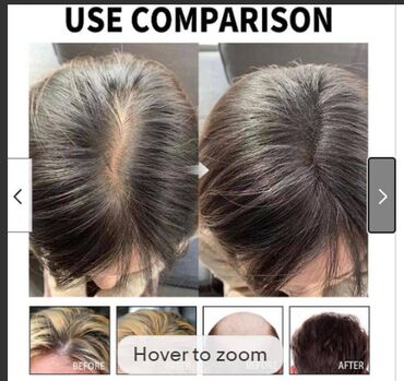 США от облысения - тонизирующая эссенция для кожи головы