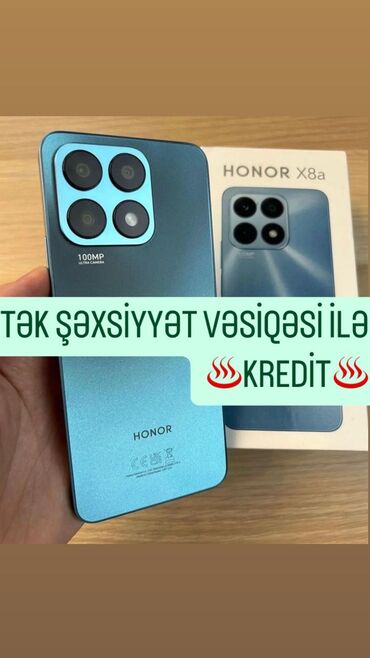 gence telefon magazalari: Honor Zəmanət, Kredit, Sensor