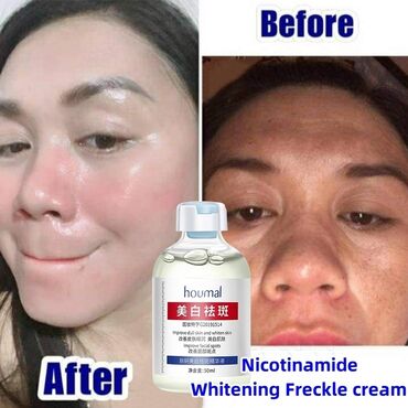 Косметика: От пигментации От пигментных пятен От веснушек Эссенция, поглощающая — 8