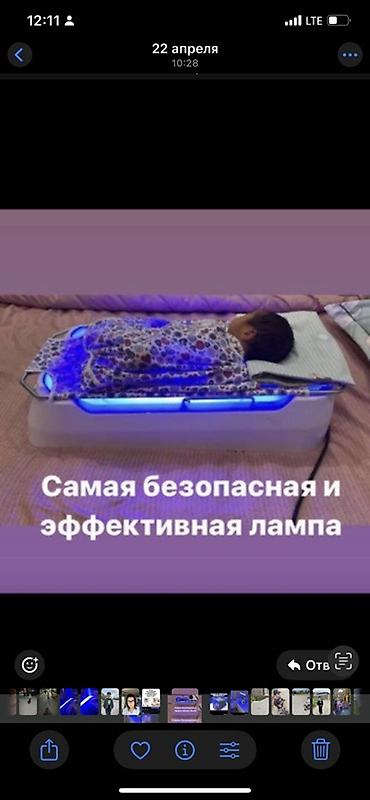 Медицинские лампы: Фотолампа от желтушки! Лечение желтушки у новорожденного с помощью — 4