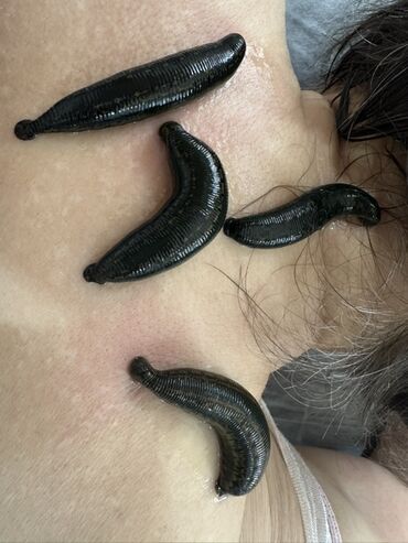 Hicama, zəli: Xidmət: Kupa terapiyası (quru və yaş/hicama), bel–boyun–çiyin masajı — 20