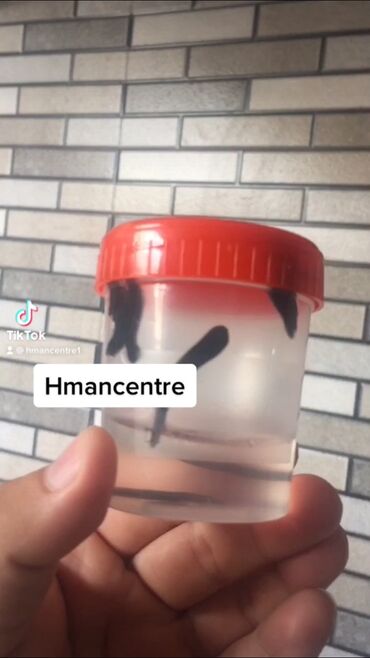 Hicama, zəli: Bəylər üçün = Hicama Və Zəli ✅Zəlinin Faydaları(Hirudoterapiya) — 13