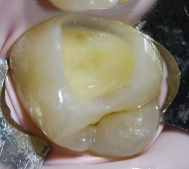 Stomatologiya: Stomatoloq Dr. Feyruz Dadaşovun fərdi praktikadasında böyüklərin və — 2