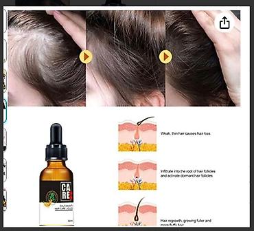 Уход за телом: США средство от облысения от выпадения волос для роста волос будит — 18