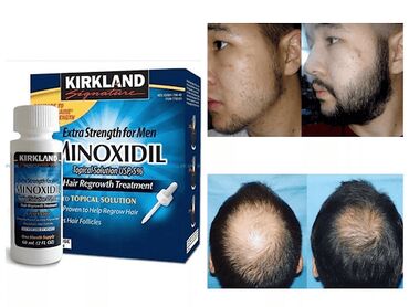Миноксидил 5% Киркланд-лосьон для роста волос и бороды