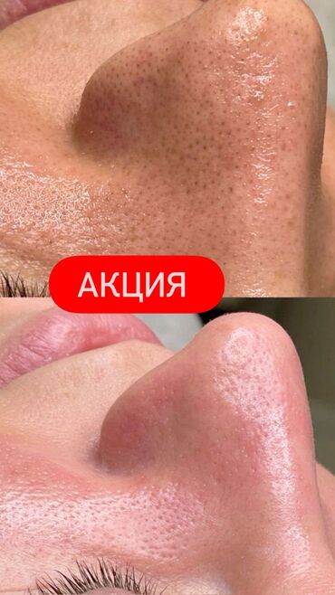 что подарить на день рождения: Косметология, Ботокс, Биоревитализация, Ботулинотерапия, Консультация, Гипоаллергенные материалы, Сертифицированный косметолог