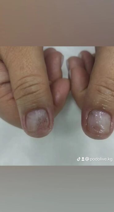 Маникюр, педикюр: Коррекция вросших ногтей, Выравнивание, Услуги подолога, Маникюр, Педикюр, С выездом на дом, Консультация, Одноразовые расходные материалы — 6