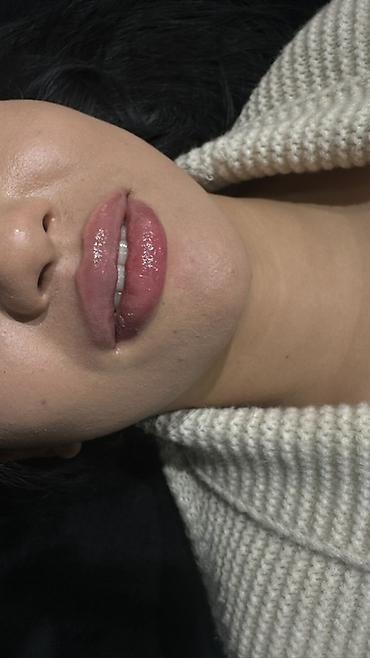 Косметология: Косметология, Увеличение губ, Гипоаллергенные материалы at lalafo.kg — 12 Косметология: Косметология, Увеличение губ, Гипоаллергенные материалы — 12